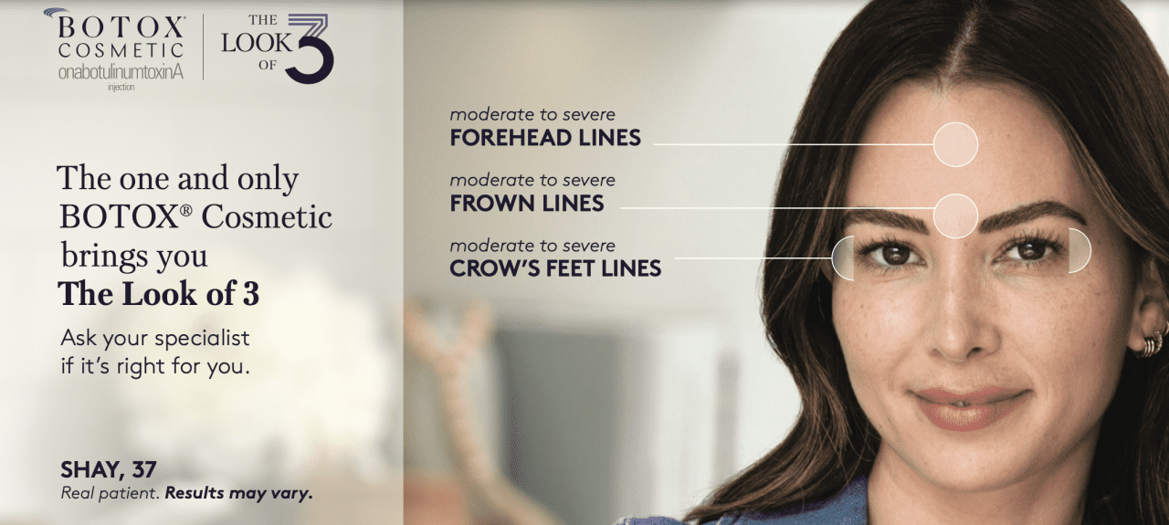 Botox Brow Lift Walnut Creek Dermatology